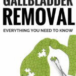 The Best Diet After Gallbladder Removal Everything You Need To Know