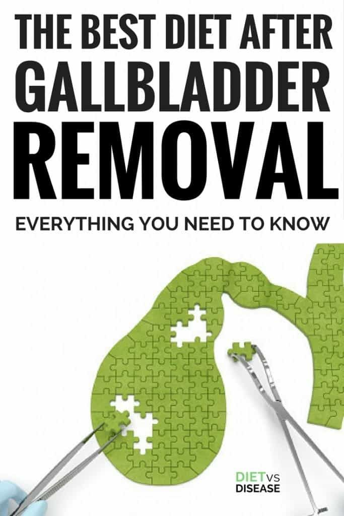 The Best Diet After Gallbladder Removal Everything You Need To Know 