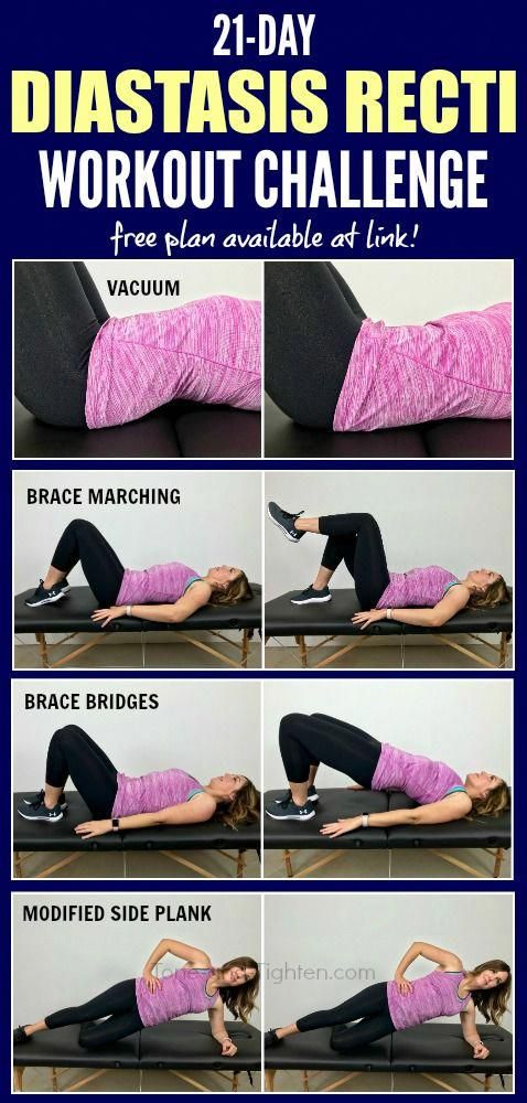 21 Day Diastasis Recti Workout Challenge Free 3 week Ab Rehab Program 