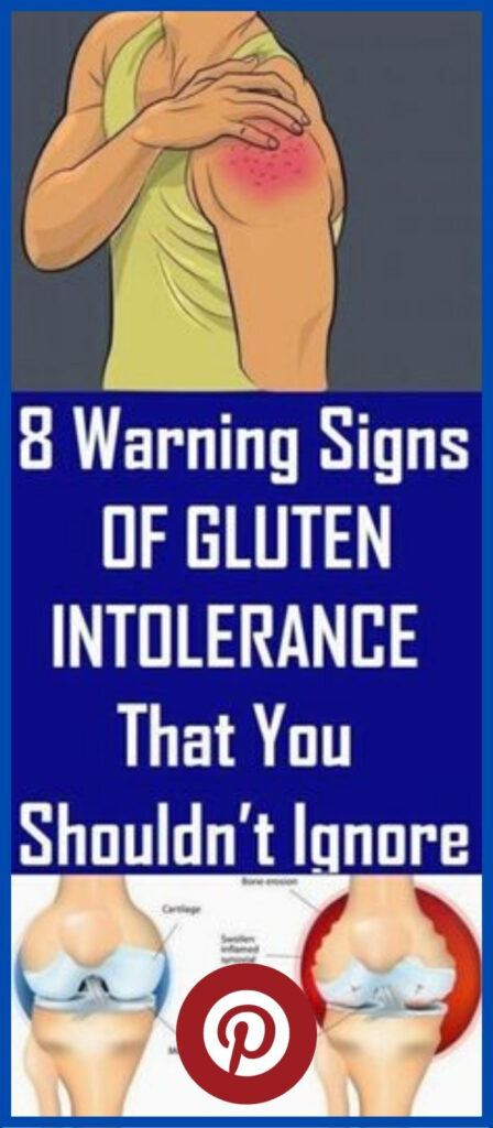 8 SIGNS YOU HAVE A GLUTEN INTOLERANCE In 2020 Signs Of Gluten 