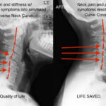 Results With Corrective Chiropractic Care Abundant Health Chiropractic